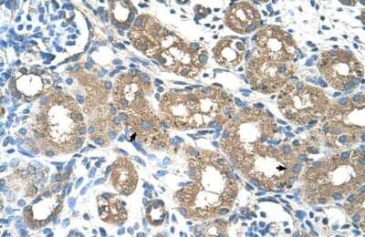 Immunohistochemistry-Paraffin: ALAS2 Antibody [NBP1-54728]