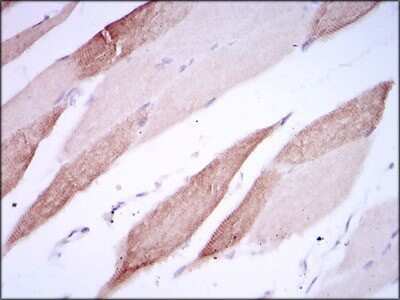 Immunohistochemistry-Paraffin: ALCAM/CD166 Antibody (5B3) - BSA Free [NBP2-22211]