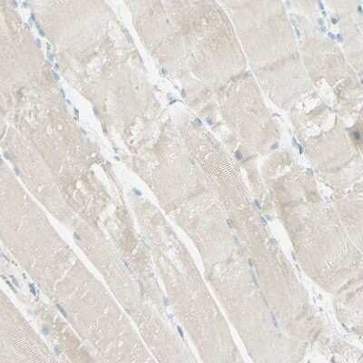 Immunohistochemistry-Paraffin: ALCAM/CD166 Antibody [NBP1-88129]