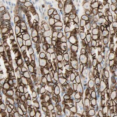 Immunohistochemistry-Paraffin: ALCAM/CD166 Antibody [NBP1-88129]