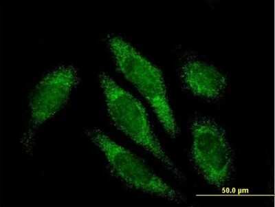 Immunocytochemistry/ Immunofluorescence: ALDH16A1 Antibody [H00126133-B01P]