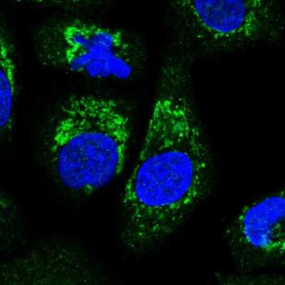 Immunocytochemistry/ Immunofluorescence: ALDH16A1 Antibody [NBP2-31774]