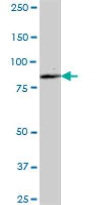 Western Blot: ALDH16A1 Antibody [H00126133-B01P]