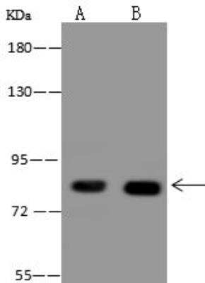 Western Blot: ALDH16A1 Antibody [NBP3-12645]