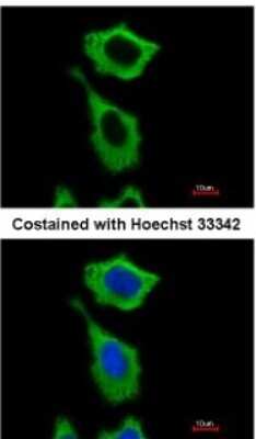 Immunocytochemistry/ Immunofluorescence: Aldehyde Dehydrogenase 1-A1/ALDH1A1 Antibody [NBP2-15334]
