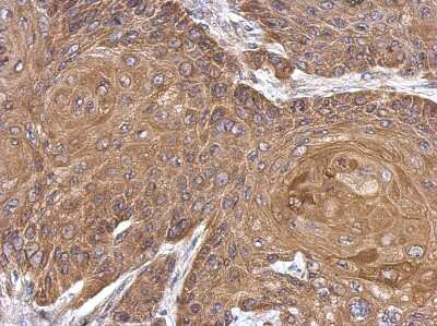 Immunohistochemistry-Paraffin: Aldehyde Dehydrogenase 1-A1/ALDH1A1 Antibody [NBP2-15334]