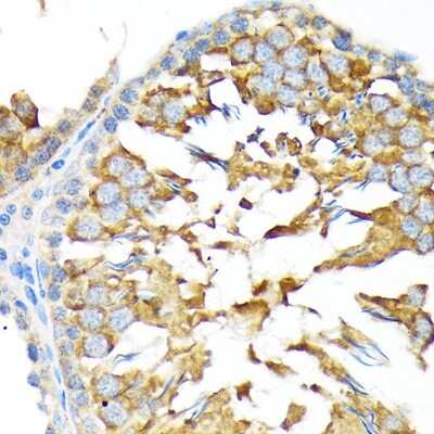 Immunohistochemistry-Paraffin: ALDH1A2 Antibody (3D2P3) [NBP3-16755]