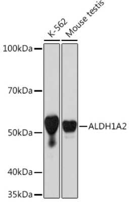 Western Blot: ALDH1A2 Antibody (3D2P3) [NBP3-16755]