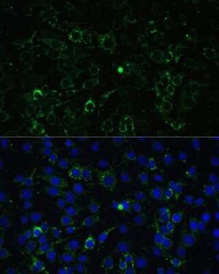 Immunocytochemistry/ Immunofluorescence: ALDH1A2 Antibody - BSA Free [NBP2-92915]