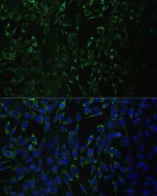 Immunocytochemistry/ Immunofluorescence: ALDH1A2 Antibody - BSA Free [NBP2-92915]