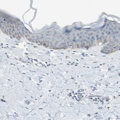 Immunohistochemistry-Paraffin: ALDH1A2 Antibody [NBP1-87158]