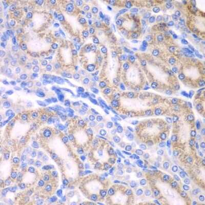 Immunohistochemistry-Paraffin: ALDH1A2 Antibody - BSA Free [NBP2-92915]