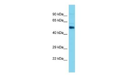 Western Blot: ALDH1A2 Antibody [NBP2-84416]