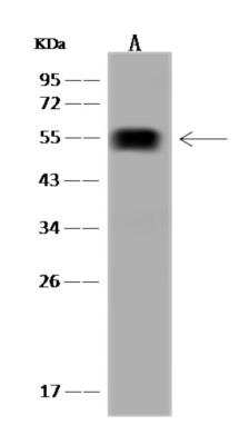 Western Blot: ALDH1A2 Antibody [NBP3-06323]