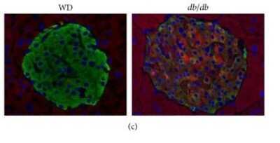 Immunohistochemistry: ALDH1A3 Antibody - BSA Free [NBP2-15339]