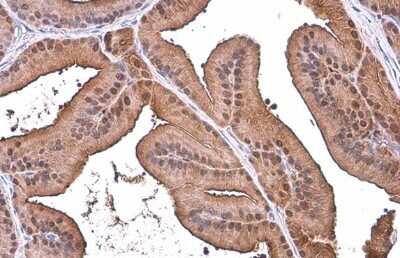 Immunohistochemistry-Paraffin: ALDH1A3 Antibody - BSA Free [NBP2-15339]