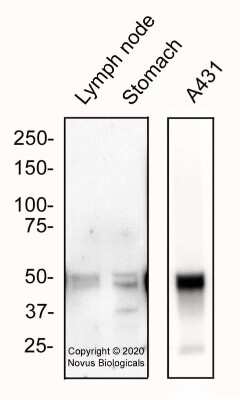 Western Blot: ALDH1A3 AntibodyBSA Free [NBP2-15339]