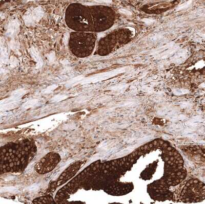 Immunohistochemistry-Paraffin: ALDH1A3 Antibody (CL11968) [NBP3-15126]