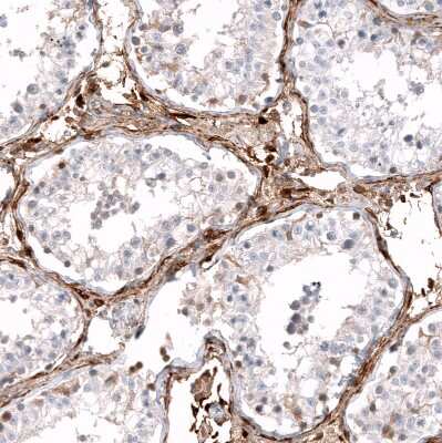 Immunohistochemistry-Paraffin: ALDH1A3 Antibody (CL11968) [NBP3-15126]