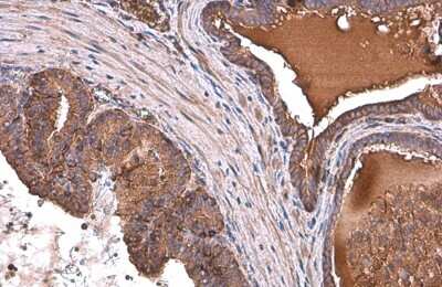 Immunohistochemistry-Paraffin: ALDH1A3 Antibody (GT926) [NBP3-13570]
