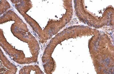 Immunohistochemistry-Paraffin: ALDH1A3 Antibody (GT926) [NBP3-13570]