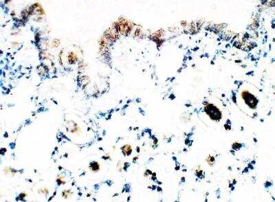 Immunohistochemistry-Paraffin: ALDH1A3 Antibody [NBP3-12280]