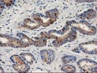 Immunohistochemistry: ALDH1A3 Antibody (OTI4E8) - Azide and BSA Free [NBP2-70154]