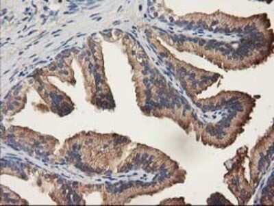 Immunohistochemistry: ALDH1A3 Antibody (OTI4E8) - Azide and BSA Free [NBP2-70154]