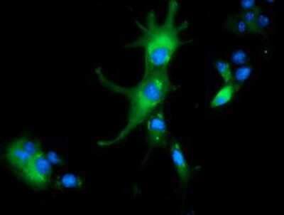 Immunocytochemistry/ Immunofluorescence: ALDH1L1 Antibody (OTI3D2) [NBP2-03143]