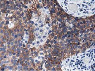 Immunohistochemistry-Paraffin: ALDH1L1 Antibody (OTI3D2) [NBP2-03143]