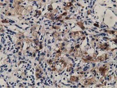 Immunohistochemistry-Paraffin: ALDH1L1 Antibody (OTI3D2) [NBP2-03143]