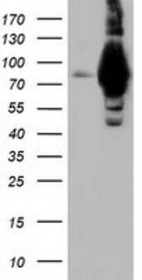 Western Blot: ALDH1L1 Antibody (OTI3D2) [NBP2-03143]