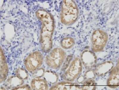Immunohistochemistry-Paraffin: ALDH1L1 Antibody (3E9) [H00010840-M01]