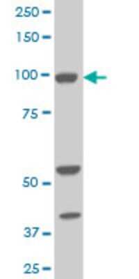 Western Blot: ALDH1L1 Antibody (3E9) [H00010840-M01]