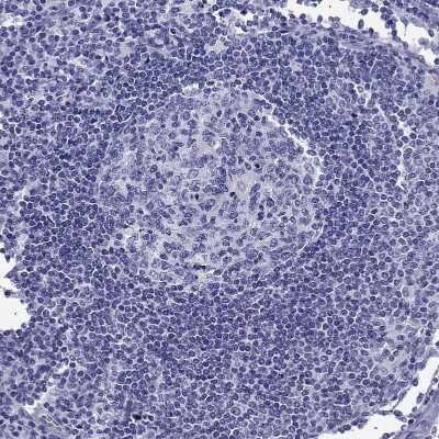Immunohistochemistry-Paraffin: ALDH1L1 Antibody [NBP2-55574]
