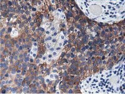 Immunohistochemistry: ALDH1L1 Antibody (OTI3D2) - Azide and BSA Free [NBP2-71629]