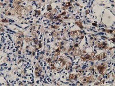 Immunohistochemistry: ALDH1L1 Antibody (OTI3D2) - Azide and BSA Free [NBP2-71629]