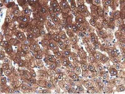 Immunohistochemistry: ALDH1L1 Antibody (OTI3D2) - Azide and BSA Free [NBP2-71629]