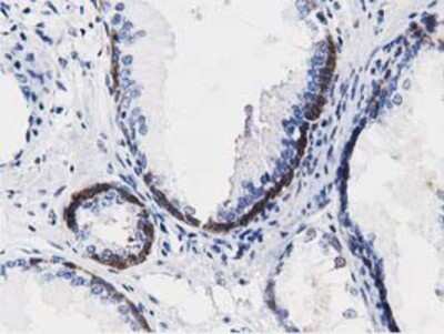 Immunohistochemistry: ALDH1L1 Antibody (OTI3D2) - Azide and BSA Free [NBP2-71629]