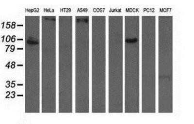 Western Blot: ALDH1L1 Antibody (OTI3D2)Azide and BSA Free [NBP2-71629]