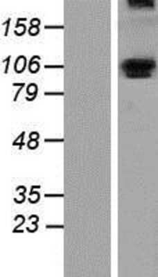 Western Blot: ALDH1L1 Overexpression Lysate [NBP2-07477]