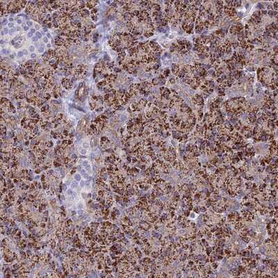 Immunohistochemistry-Paraffin: ALDH1L2 Antibody [NBP1-81935]