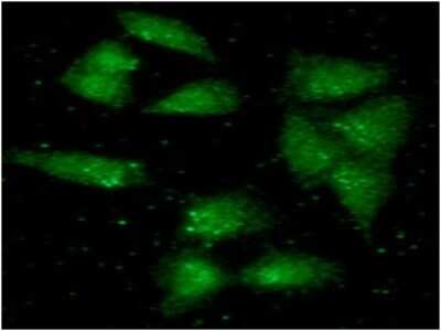 Immunocytochemistry/ Immunofluorescence: ALDH2 Antibody (2C10) - BSA Free [NBP2-59488]