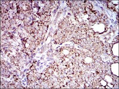 Immunohistochemistry: ALDH2 Antibody (4G6A3) - BSA Free [NBP2-37397]