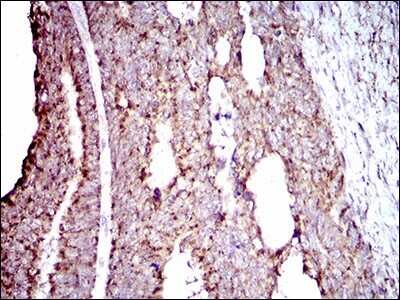 Immunohistochemistry: ALDH2 Antibody (4G6A3) - BSA Free [NBP2-37397]