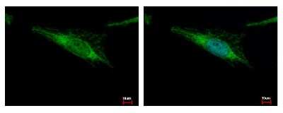 Immunocytochemistry/ Immunofluorescence: ALDH2 Antibody [NBP1-31749]