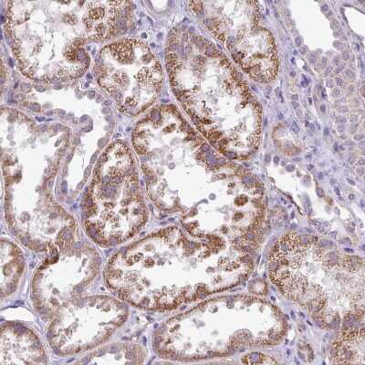 Immunohistochemistry-Paraffin: ALDH2 Antibody [NBP2-14280]