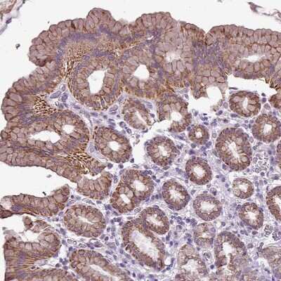 Immunohistochemistry-Paraffin: ALDH2 Antibody [NBP2-14280]