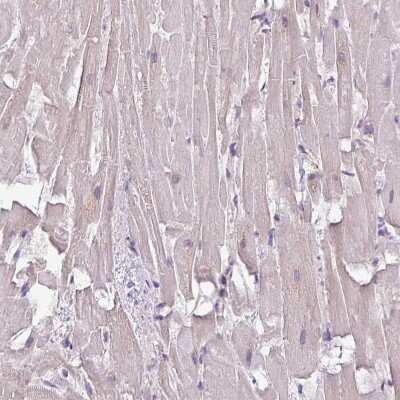 Immunohistochemistry-Paraffin: ALDH2 Antibody [NBP2-14280]