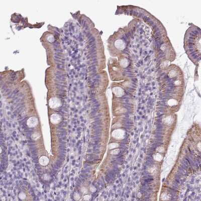 Immunohistochemistry-Paraffin: ALDH2 Antibody [NBP2-14280]